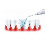Oral irrigator: what to look for when choosing